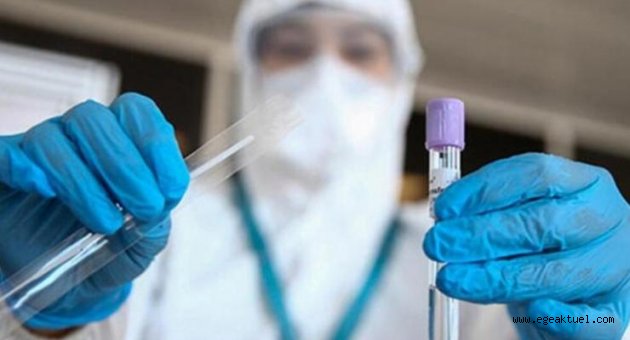 Türk bilim insanları üretti: Koronavirüsü 15 saniyede teşhis ediyor